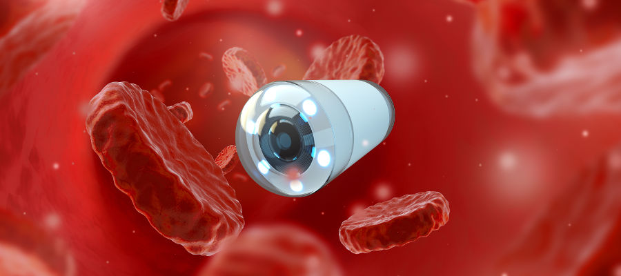 Videocápsula Endoscópica - Agenda tu cita en Bogotá